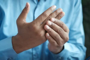 image of a hand with joints problem